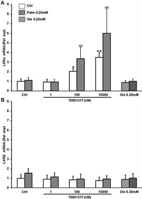 Induction of Stearoyl-CoA 9-Desaturase 1 Protects Human Mesenchymal Stromal Cells Against Palmitic Acid-Induced Lipotoxicity and Inflammation